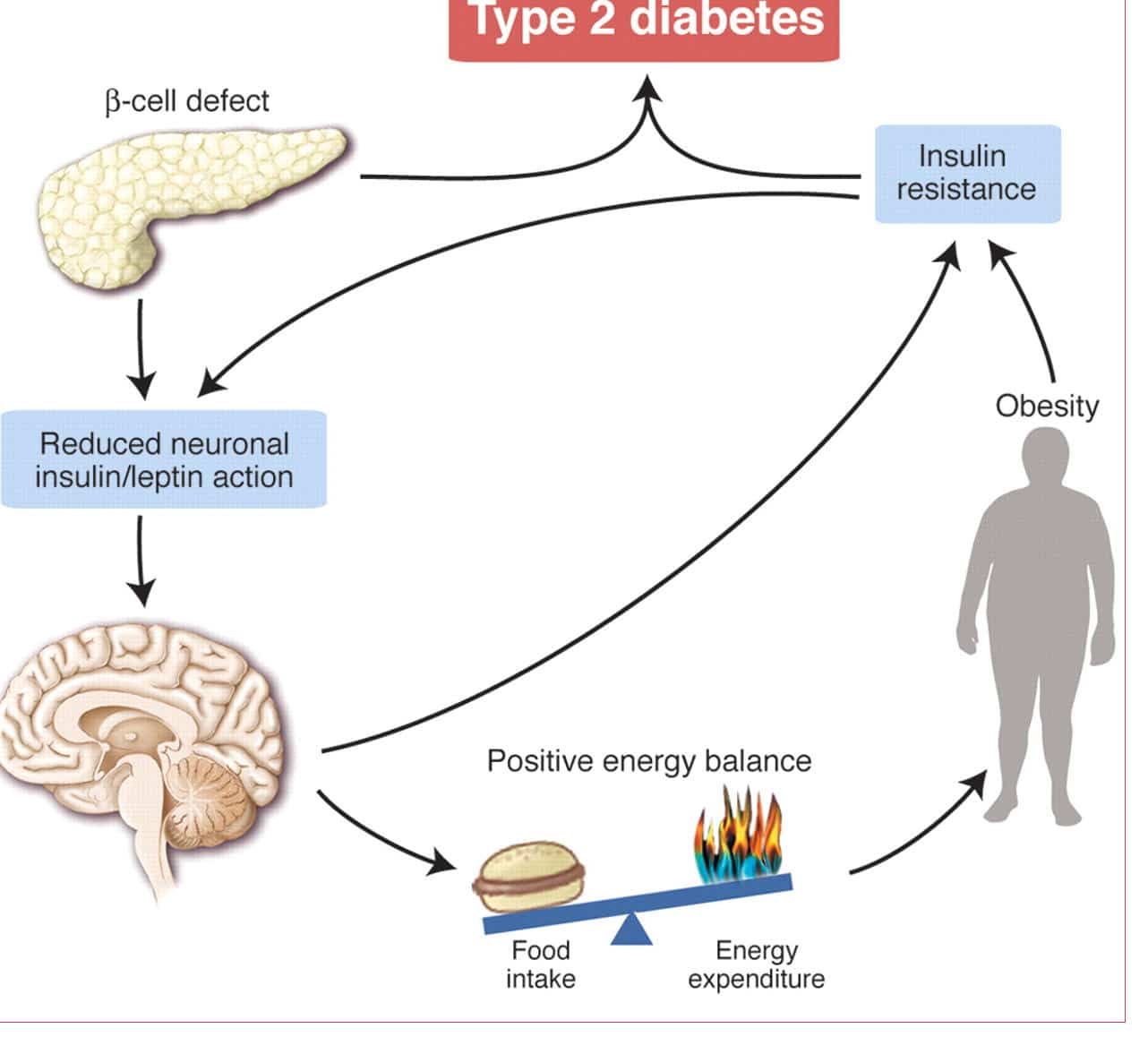 Weight Gain With Insulin Resistance Baby Health