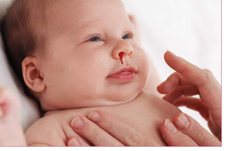 babies head shapes when to worry babies head shapes when to worry
