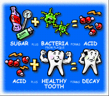 Feeding-bottle dental decay